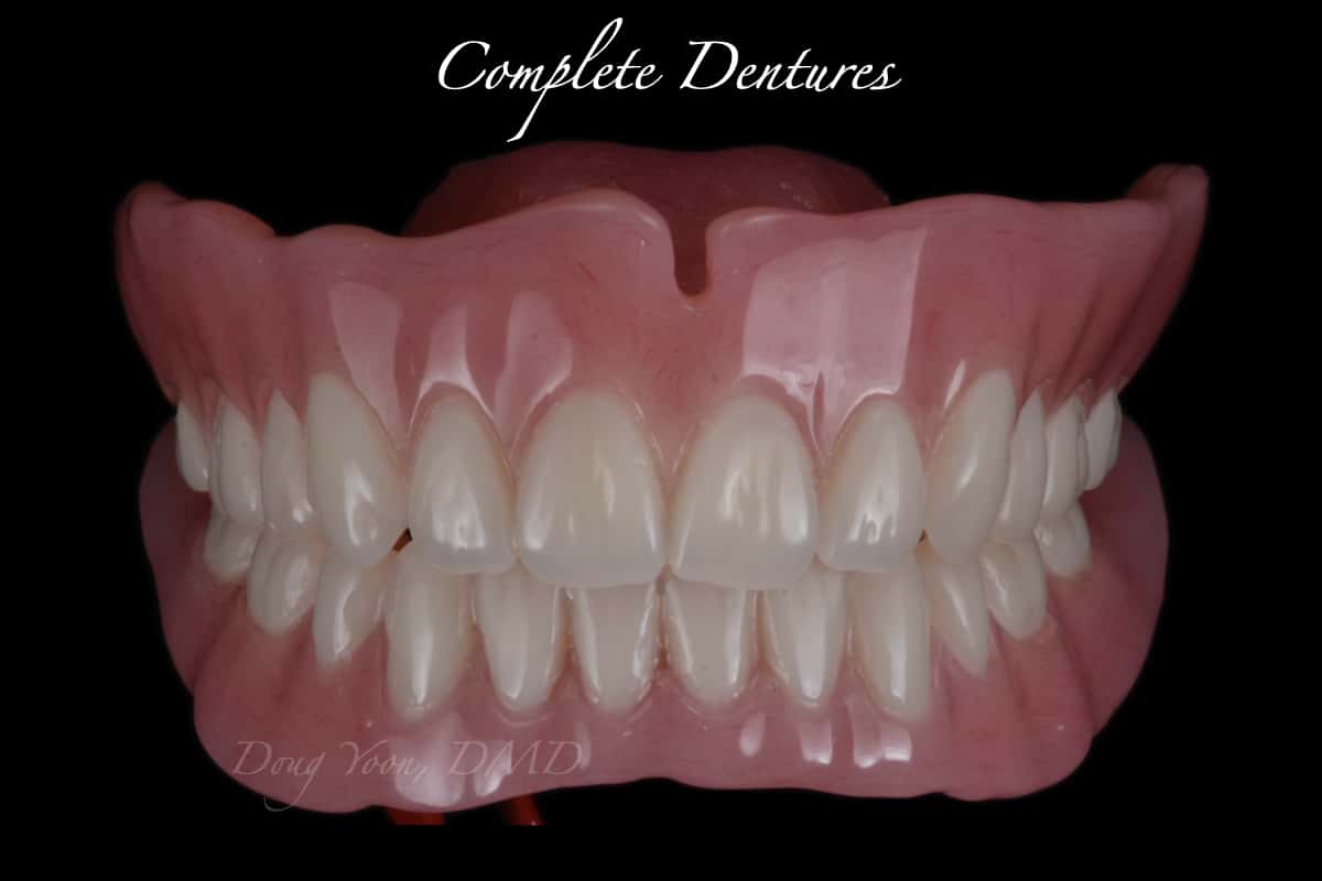 Complete Dentures