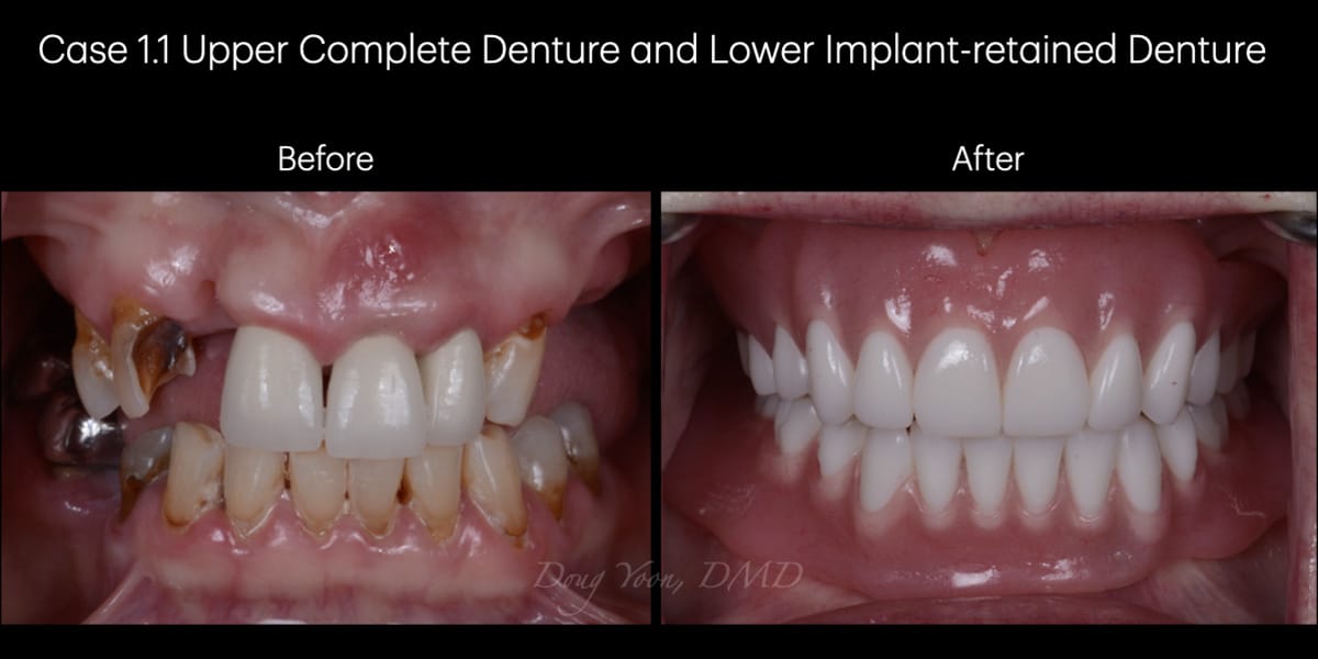 Moonglow Website Before After Smile Gallery Copy