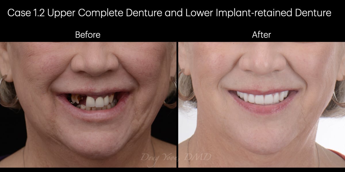 Moonglow Website Before After Smile Gallery.002