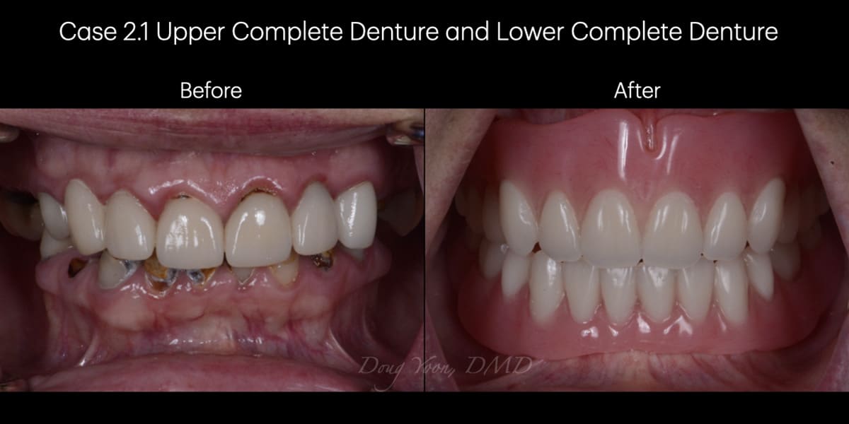 Moonglow Website Before After Smile Gallery.003