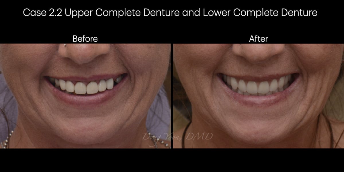Moonglow Website Before After Smile Gallery.004