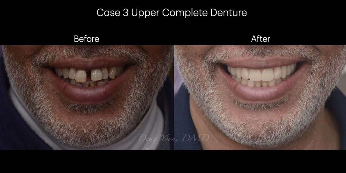 Moonglow Website Before After Smile Gallery.005