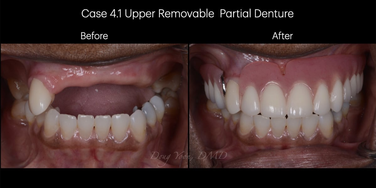 Moonglow Website Before After Smile Gallery.006