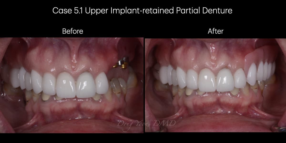 Moonglow Website Before After Smile Gallery.008