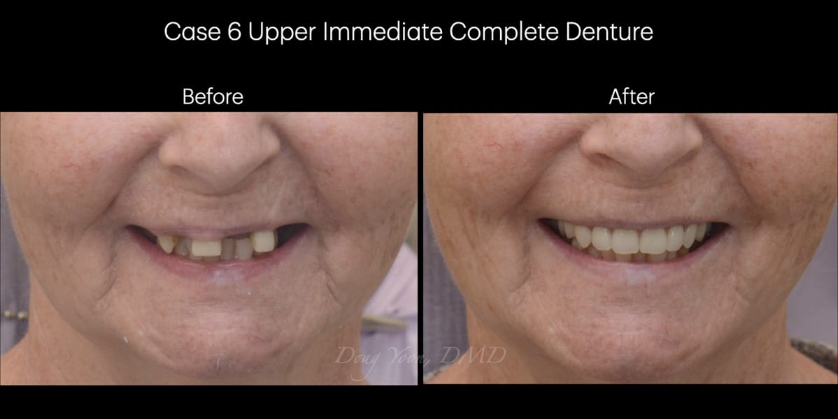 Moonglow Website Before After Smile Gallery.010