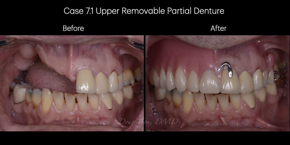 Moonglow Website Before After Smile Gallery.011
