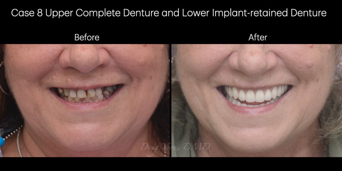 Moonglow Website Before After Smile Gallery.013