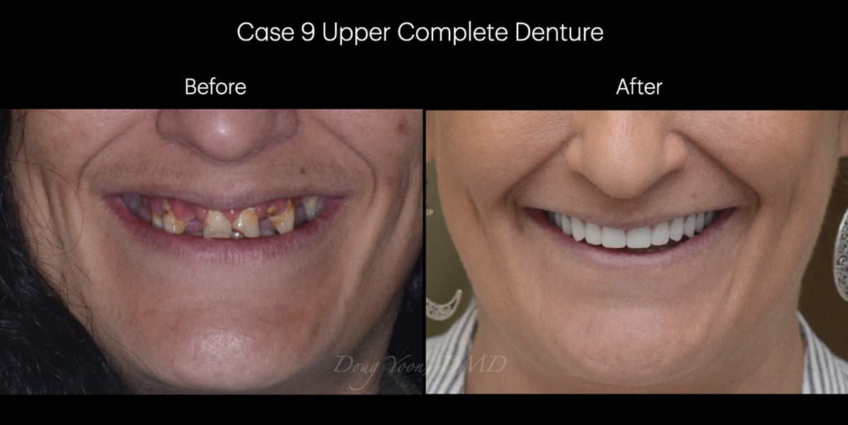 Moonglow Website Before After Smile Gallery.014