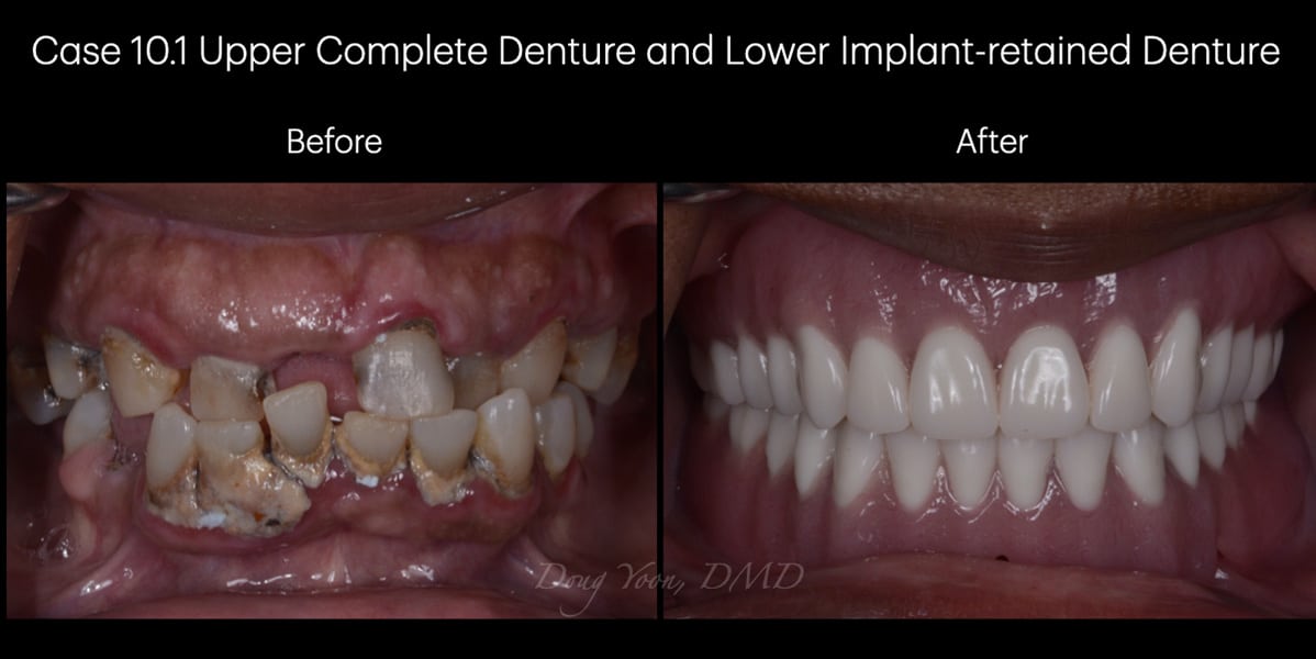 Moonglow Website Before After Smile Gallery.015