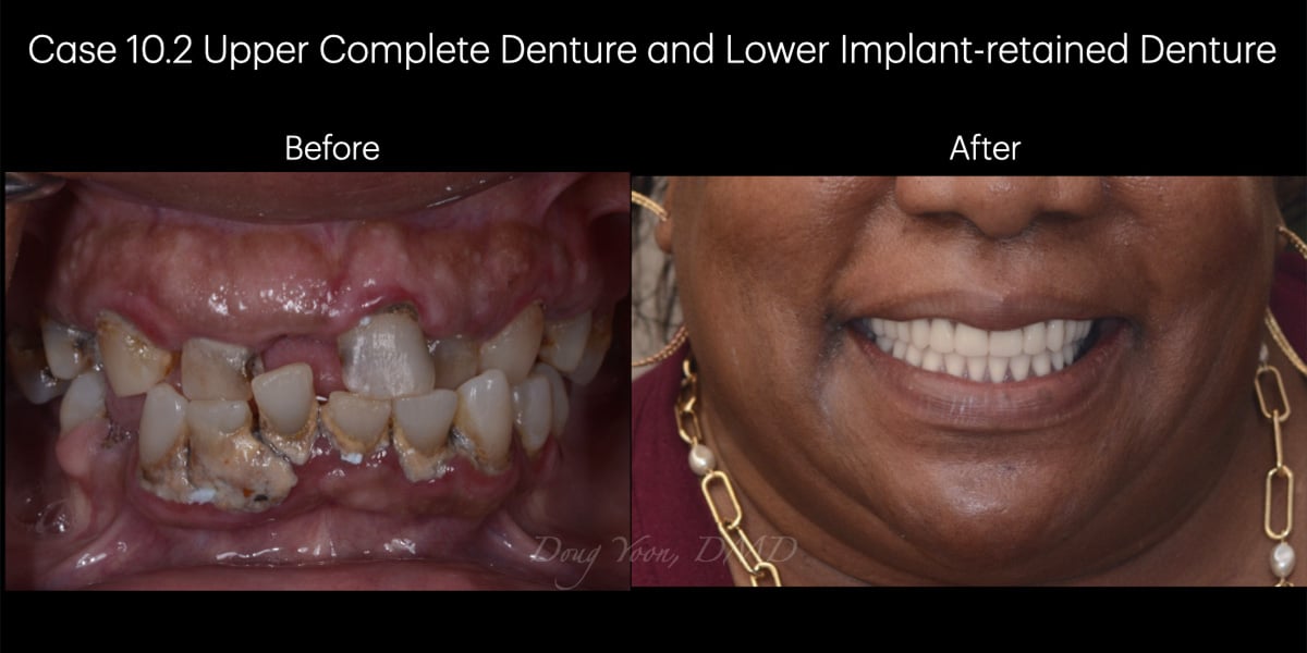 Moonglow Website Before After Smile Gallery.016