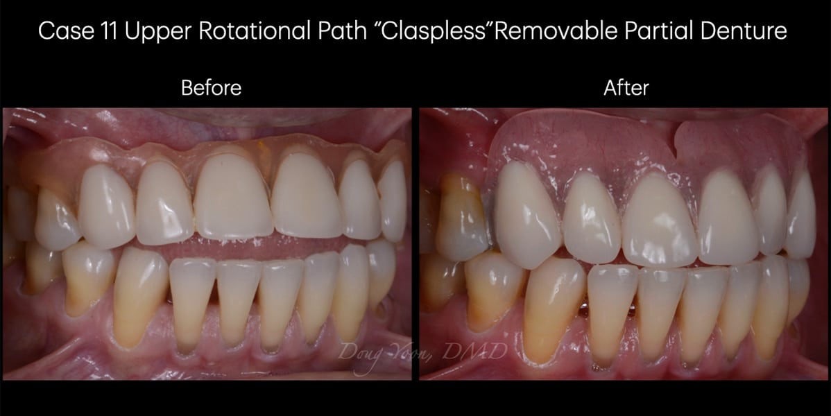 Moonglow Website Before After Smile Gallery.017