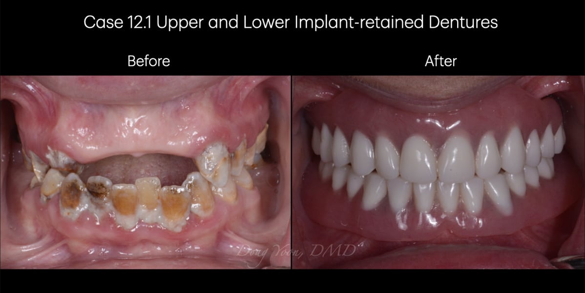 Moonglow Website Before After Smile Gallery.018
