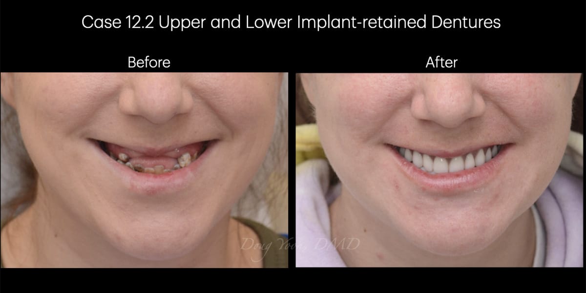 Moonglow Website Before After Smile Gallery.019