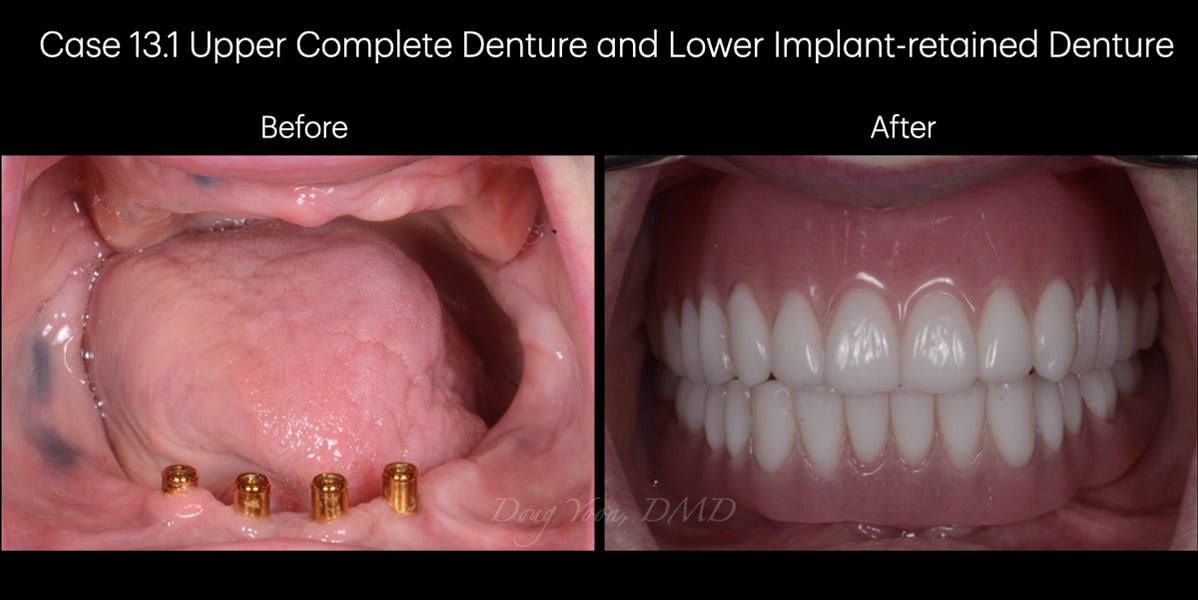 Moonglow Website Before After Smile Gallery.020