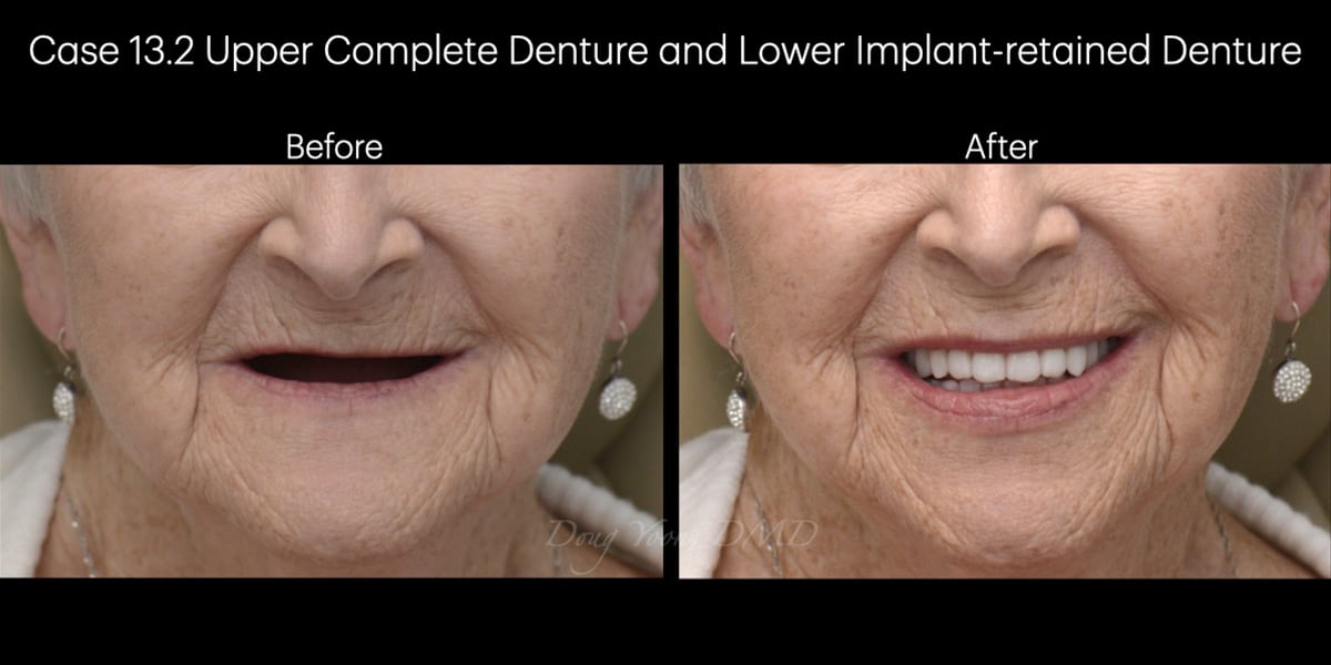 Moonglow Website Before After Smile Gallery.021
