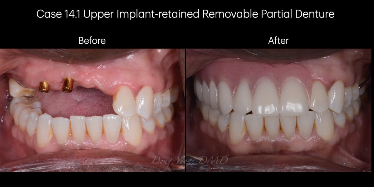 Moonglow Website Before After Smile Gallery.022