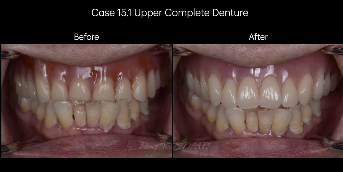 Moonglow Website Before After Smile Gallery.024