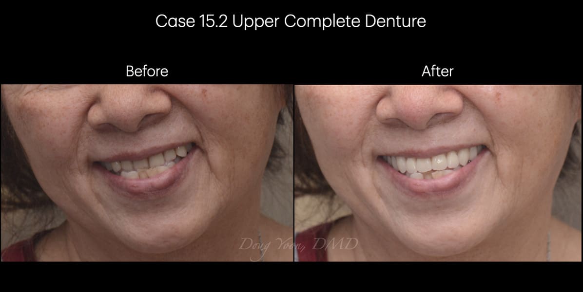 Moonglow Website Before After Smile Gallery.025