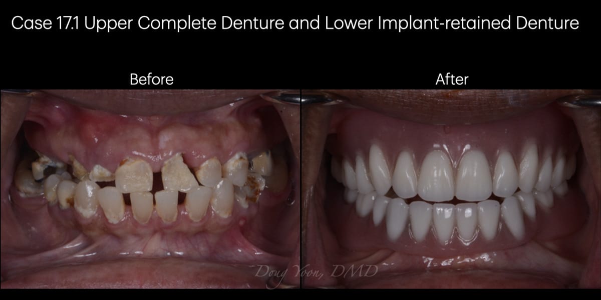 Moonglow Website Before After Smile Gallery.028