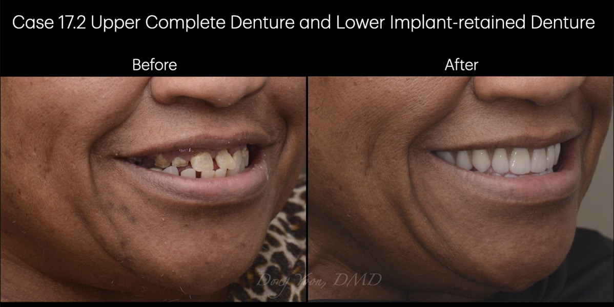 Moonglow Website Before After Smile Gallery.029