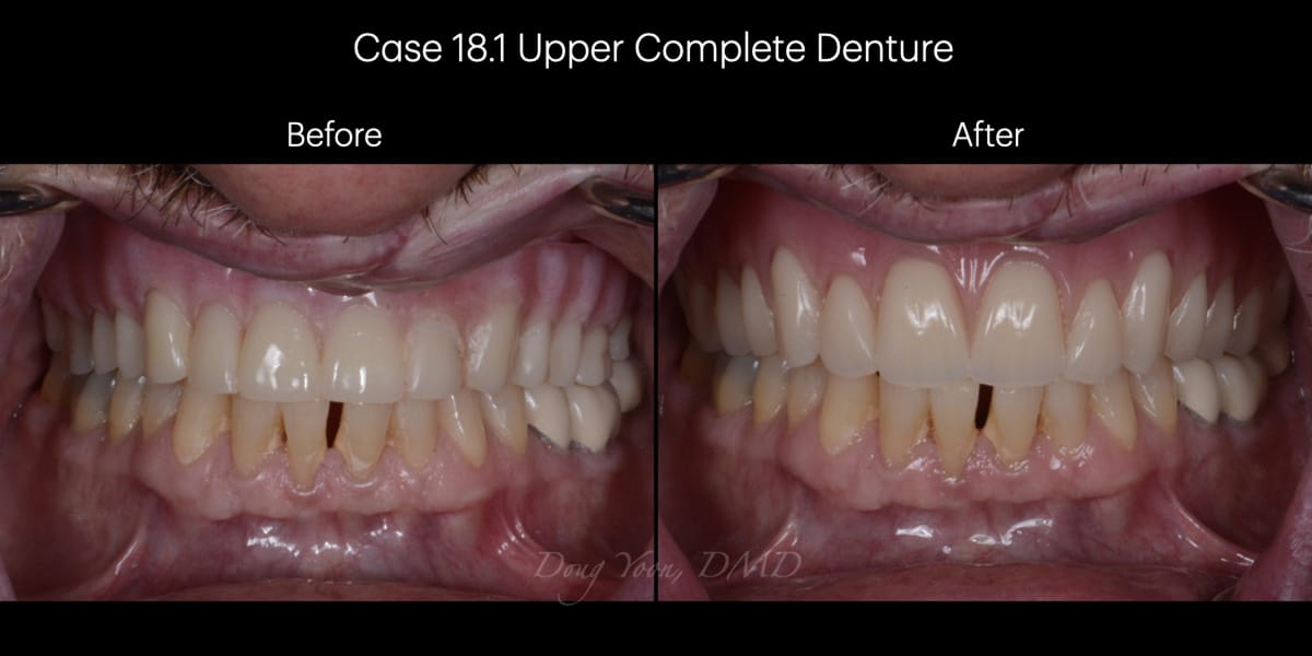 Moonglow Website Before After Smile Gallery.030