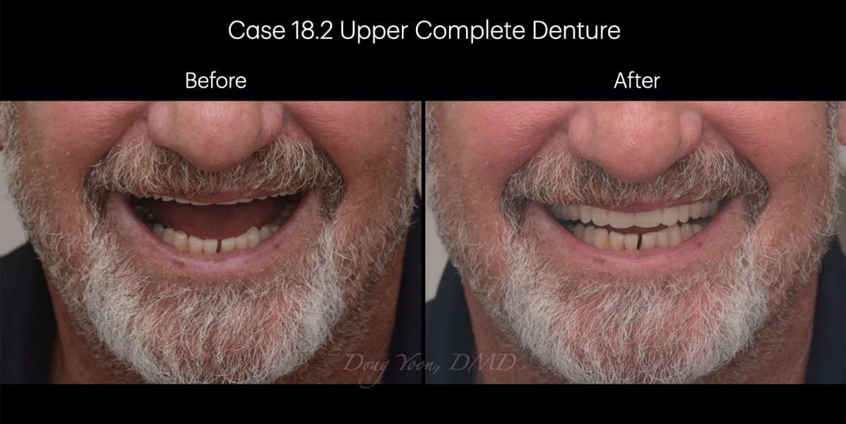 Moonglow Website Before After Smile Gallery.031
