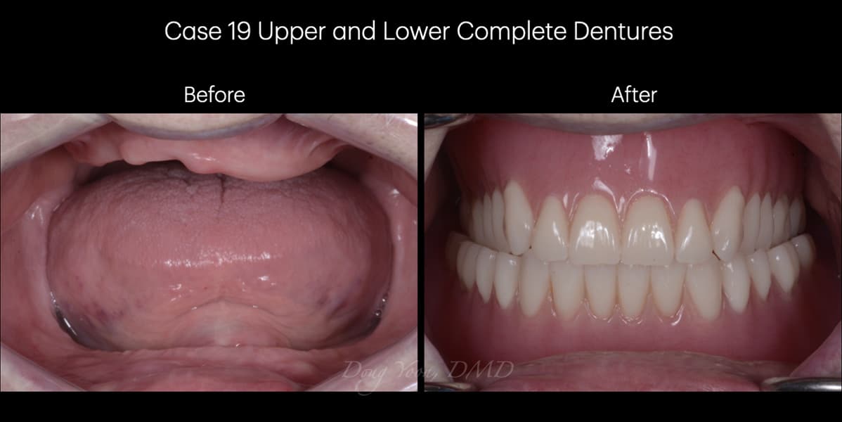 Moonglow Website Before After Smile Gallery.032