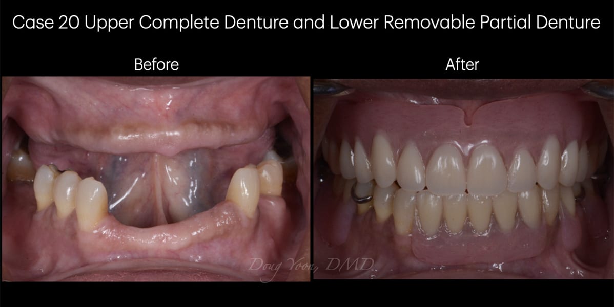 Moonglow Website Before After Smile Gallery.033