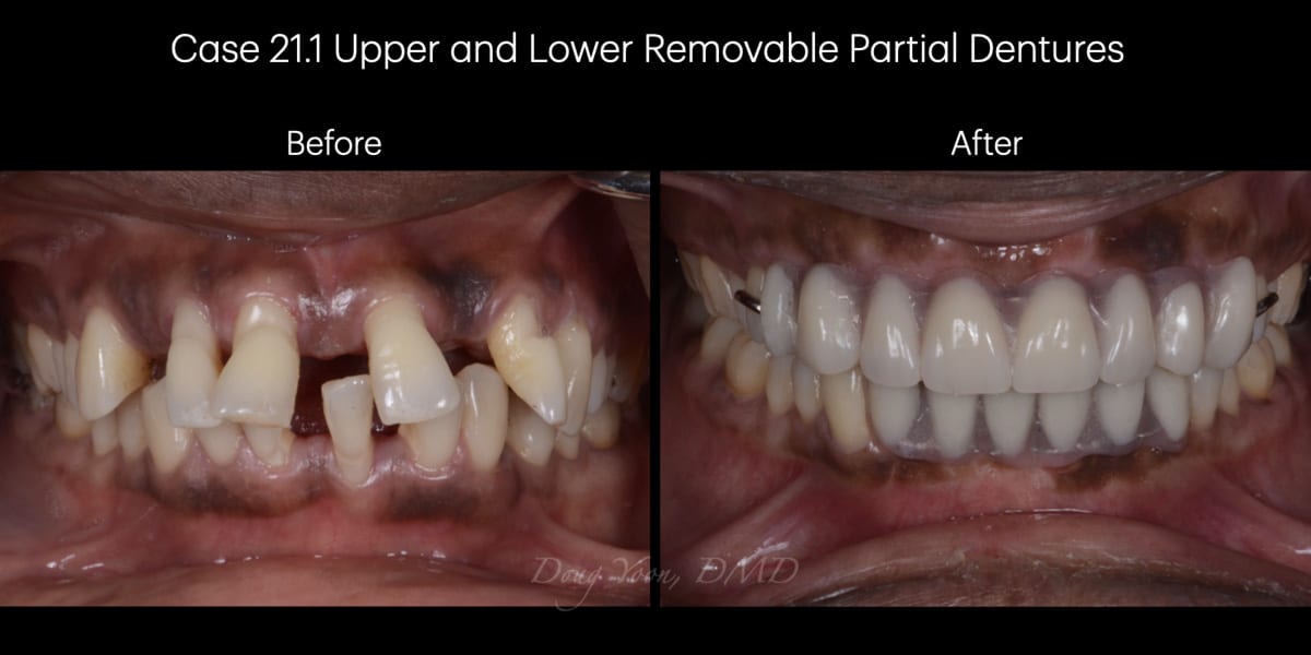 Moonglow Website Before After Smile Gallery.034