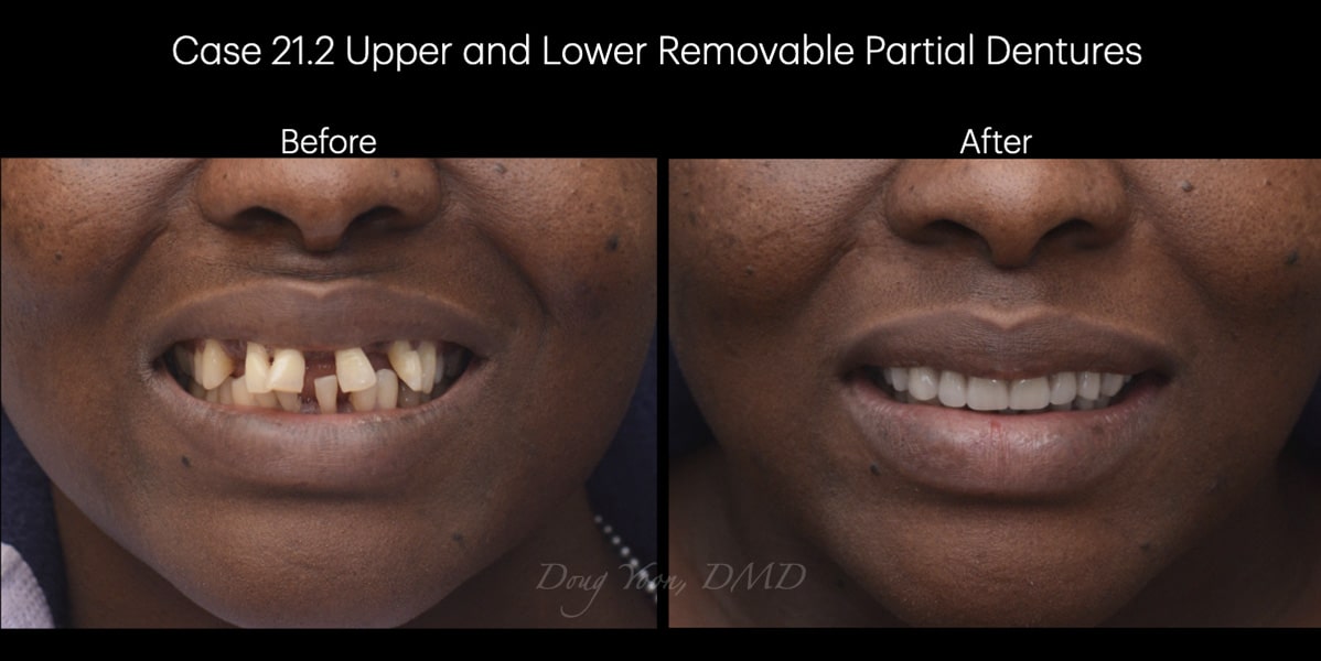 Moonglow Website Before After Smile Gallery.035