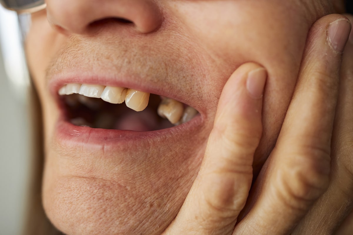 How facial structure changes after tooth loss and how dentures help blog